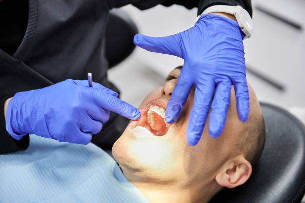 Best Broken or Cracked Tooth Emergency Dentist in Milliken, CO